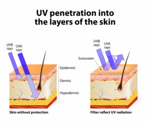 Without protection, UVB rays penetrate the epidermis and UVA rays penetrate the dermis. With sun protection, UVB and UVA rays are reflected off of the epidermis and the rays to not penetrate the skin.